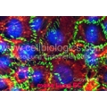 BKS db Control Mouse Aortic Endothelial cells
